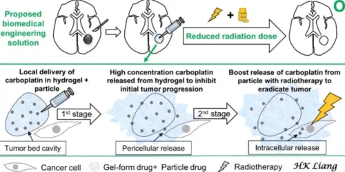 Breakthrough Drug Delivery System Enhances Radiotherapy for Malignant Gliomas