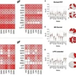 Machine Learning Study Reveals New Insights Into Brain Connections and Intelligence