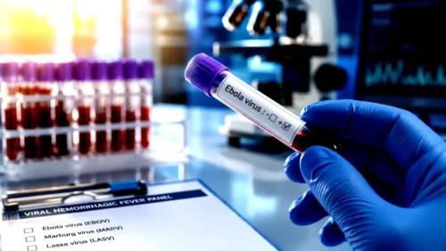 Ebola virus test