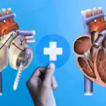 Bionic Organs Revolutionizing Healthcare and Redefining Human Potential