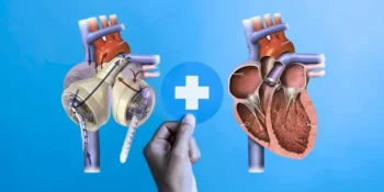 Bionic Organs Revolutionizing Healthcare and Redefining Human Potential