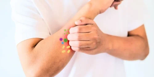 Scientists Unveiled the Bacteria's Role in Triggering Skin Itchiness