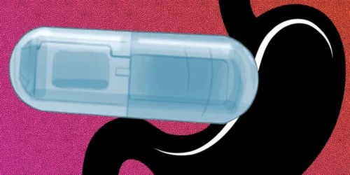 Researchers Develop Vibrating Pill to Induce Feelings of Fullness, Potential Treatment for Obesity
