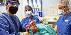 Xenotransplantation Breakthroughs Pave the Way for Organ Transplants