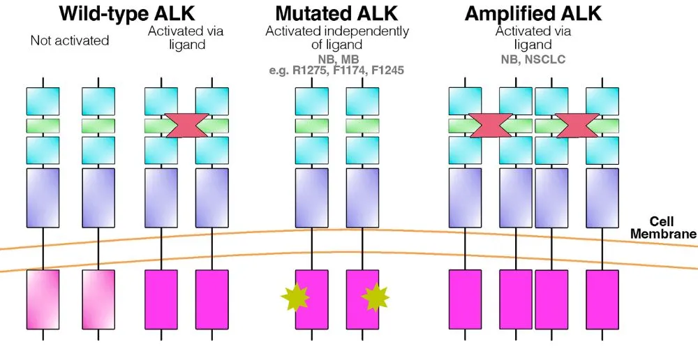Research Explores ALK's Role in Non-Glial Brain Tumors of the Posterior Fossa