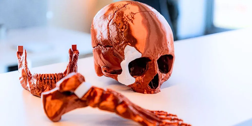 Breakthroughs in 3D-Printed Bones Pave the Way for Personalized Healthcare