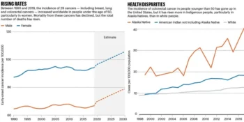 Rising Rates of Early-Onset Cancer Spark Global Concern